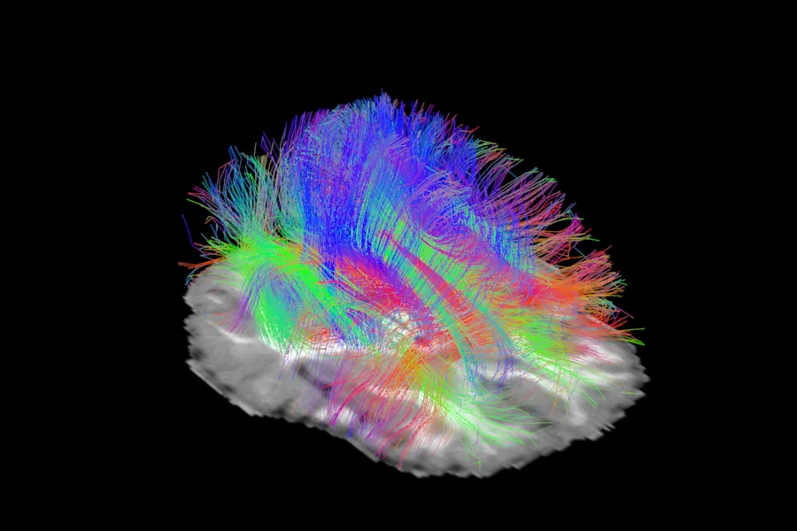 3D view from above: long streamlines as thin lines over an axial slice of the T1-like image